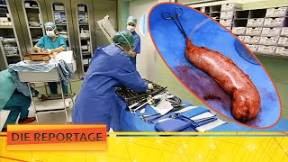 Das Leben mit Übergewicht  eine Magenoperation als letzter Ausweg 👨‍⚕️  22  Die Reportage  ATV [upl. by Nmutua]