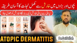 Jock itch home remedies  Jock itch treatment at home  Jock itch cream for private parts Dr saif [upl. by Camila679]