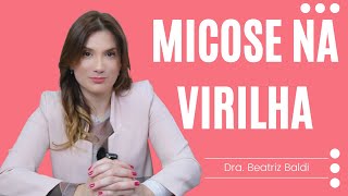 Micose na virilha  Dra Beatriz Franchito Baldi [upl. by Dag]