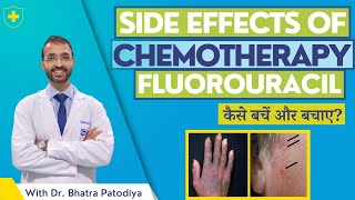 Fluorouracil  Side Effects Of Chemotherapy  Avoid With Easy 7 Steps  Dr Bharat Patodiya [upl. by Lenuahs416]