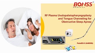 RF Plasma Uvulopalatopharyngoplasty and Tongue Channeling for Obstructive Sleep Apnea [upl. by Gnilrets]