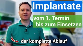 Zahnimplantate vom 1 Termin bis zur Fertigstellung kompletter Ablauf [upl. by Zillah513]