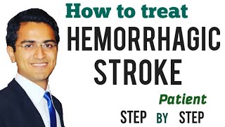 Hemorrhagic Stroke Intracerebral Hemorrhage Emergency Treatment Management Medicine Lecture USMLE [upl. by Arjun]