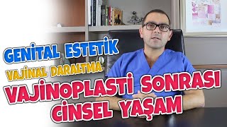 VAJİNOPLASTİ SONRASI CİNSEL YAŞAM [upl. by Sverre]