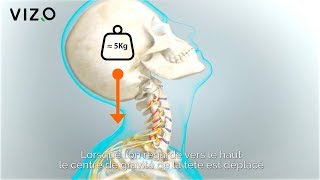 Extension cervicale Douleur au cou arthrose cervicale fourmillement dans les bras [upl. by Dukey875]