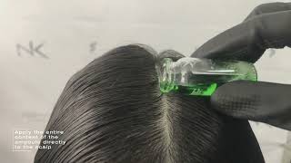 Simple home remedies to prevent hair loss and regrow hair naturally in 2 weeks I Stop hair fall 2021 [upl. by Tamara]