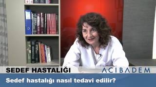 Sedef hastalığı nasıl tedavi edilir [upl. by Marfe]