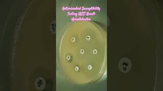 Antibiotics Sensitivity Testing AST of Acinetobacter baumannii complex microbiology microbes [upl. by Carola12]