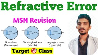 Refractive Errors  Hypermetropia  Myopia  Astigmatism  MSN Important Topic Eye MSN [upl. by Nealson]