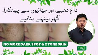 No more Dark Spots amp Two Tone Skin  Pigmentation treatment at home  Dark Spots on Face Removal [upl. by Elitnahc]