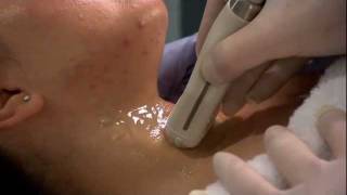 Ultrasound Training Thyroid and Parathyroid Glands [upl. by Eamanna752]