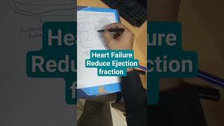 Heart failure reduced ejection fractionWhat is heart failure with reduce ejection fraction Intro [upl. by Burger]