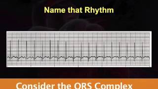 EKG Basics  Part 2 of 3 [upl. by Hoopes]