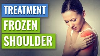 Frozen Shoulder  Causes and Treatment [upl. by Eirrehs67]