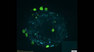 2023 BioArt Video Entry Ovarian Cancer 3D Spheroid amp Macrophage Fusion [upl. by Erdna]