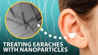 Treating earaches with nanoparticles that generate antiseptic on demand  Headline Science [upl. by Haneeja]