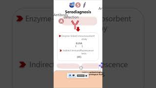 SerodiagnosisGiardia lamblia parasitology microbiology pathology diagnosis neetpg neet [upl. by Elmore]