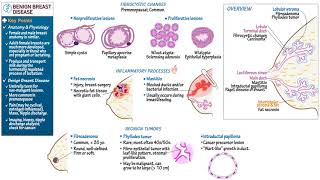 Benign Breast Diseases [upl. by Gonta395]