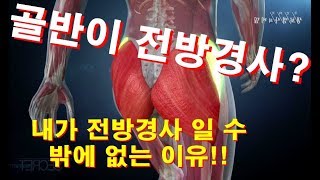 골반이 전방경사 내가 전방경사 일 수 밖에 없는 이유 [upl. by Aronow79]