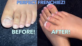 FRENCH ACRYLIC TOES ACRYLIC OVERLAY ON TOES [upl. by Hamish613]