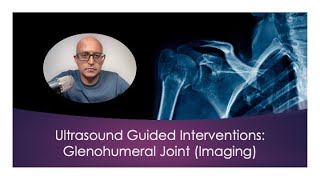 Ultrasound Guided Interventions Glenohumeral Joint Imaging ultrasound [upl. by Kola]