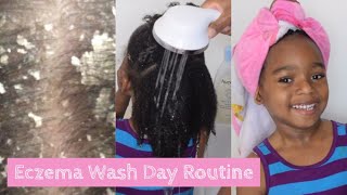 Eczema Wash Day Routine For Kids No More Itchy Scalp Seborrheic DERMATITIS [upl. by Saideman134]