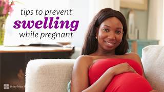 Things That Make You Swell When You’re Pregnant [upl. by Nita]