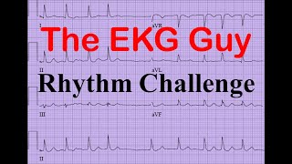 EKGECG  Rhythm Challenge 40  The EKG Guy [upl. by Eastlake]