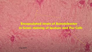 Acinetobacter in clinical sample Sputum Gram stain Microscopy at various magnifications [upl. by Aneelahs39]