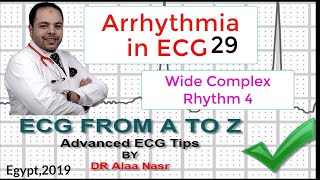 ECG from A to Z intermediate level Arrhythmia 29 Dr Alaa Nasr 2019 [upl. by Leighland836]