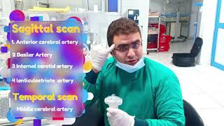 Neonatal Cranial ultrasound 🧠  practical technique 👌 DrMohamed Soliman [upl. by Unni]