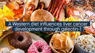 A Western diet affects galectin1 signaling promoting the development of liver cancer [upl. by Furlong702]