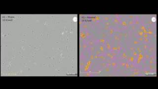 Study of Neurite Dynamics using NeuroTrack Assay [upl. by Skye185]