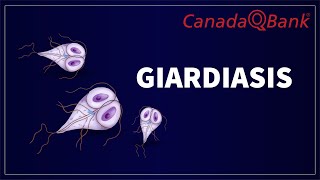 Giardiasis [upl. by Cimbura]