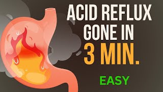 How I Stopped Years of Stomach Acid Reflux or Heart Burn– Here’s What Works [upl. by Craw345]