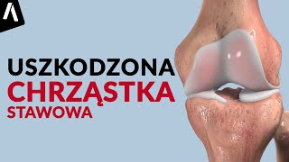 Uszkodzona chrząstka stawowa a choroba zwyrodnieniowa stawów [upl. by Bernardi]