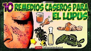 Como Combatir el Lupus Naturalmente  10 Remedios Caseros para Tratar el Lupus👈 [upl. by Pellikka]