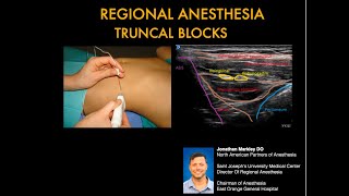 Regional Anesthesia for Abdominal Surgery by Jonathan Markley DO [upl. by Copland954]