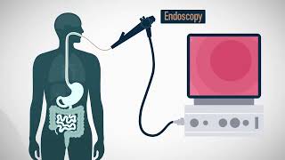 MiGUT  An ingestible device for gastric electrophysiology [upl. by Kayne]