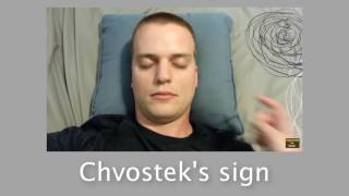 Path Bites How to remember Chvostek and Trousseau signs [upl. by Oigolue]