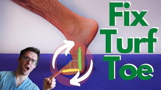 Turf Toe Injury BEST Treatment Causes Symptoms amp 3 Grades [upl. by Ylelhsa]