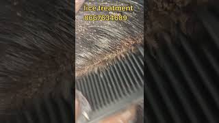 Lice treatment nits hair headlice peenu lice headliceremoval eerunits and licetreatment [upl. by Elbys]