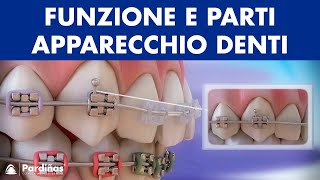 Ortodonzia  Funzione e parti apparecchio denti © [upl. by Nadine]