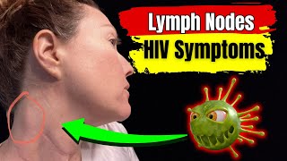 Lymph Nodes HIV Symptoms  Understanding HIVRelated Swollen Lymph Nodes [upl. by Itin955]