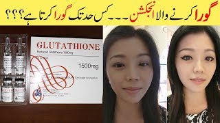 Glutathione Skin Whitening Injections Explained Before amp After Results Urdu HIndi [upl. by Lagas]