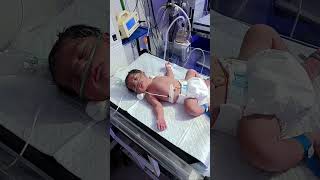 Today NB cute baby birth RDS treatment on CPAP in Nicu 🚼💉👨‍⚕️🏥 [upl. by Enirehtak]