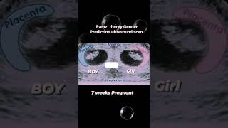 Ramzi Theory Gender Prediction Ultrasound Scan shortsfeed mother motherhood pregnancy [upl. by Gibe]