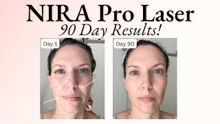 90 Day Results Using NIRA Pro Laser  Before amp After Photos  Fine Lines Wrinkles amp Build Collagen [upl. by Tamiko]