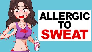 Allergic To Sweat [upl. by Savory]