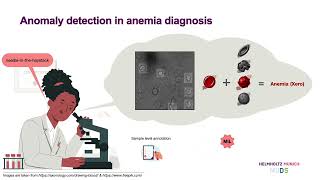 MICCAI 2022  Anomally aware MIL for rare anemia disorder classification [upl. by Draper524]